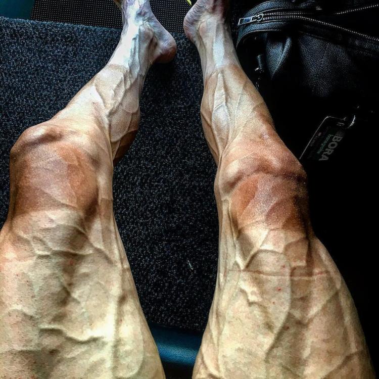 Так выглядят ноги велосипедиста во время чемпионата Тур де Франс. И без того худые, они набирают крови от постоянной работы и принимают такой пугающий вид.