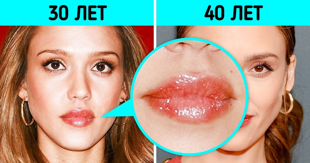 Внешние признаки старения