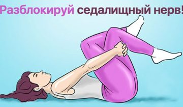 защемление седалищного нерва