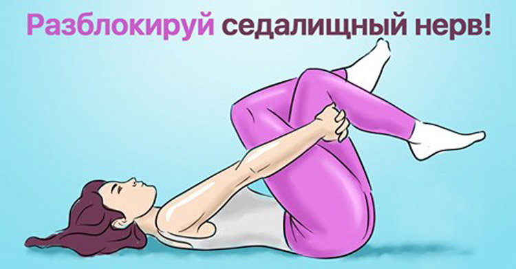 защемление седалищного нерва