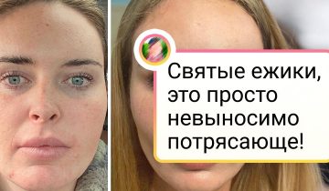 пластический хирург сотворил чудо