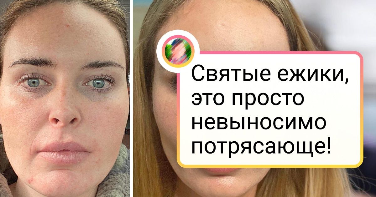 пластический хирург сотворил чудо