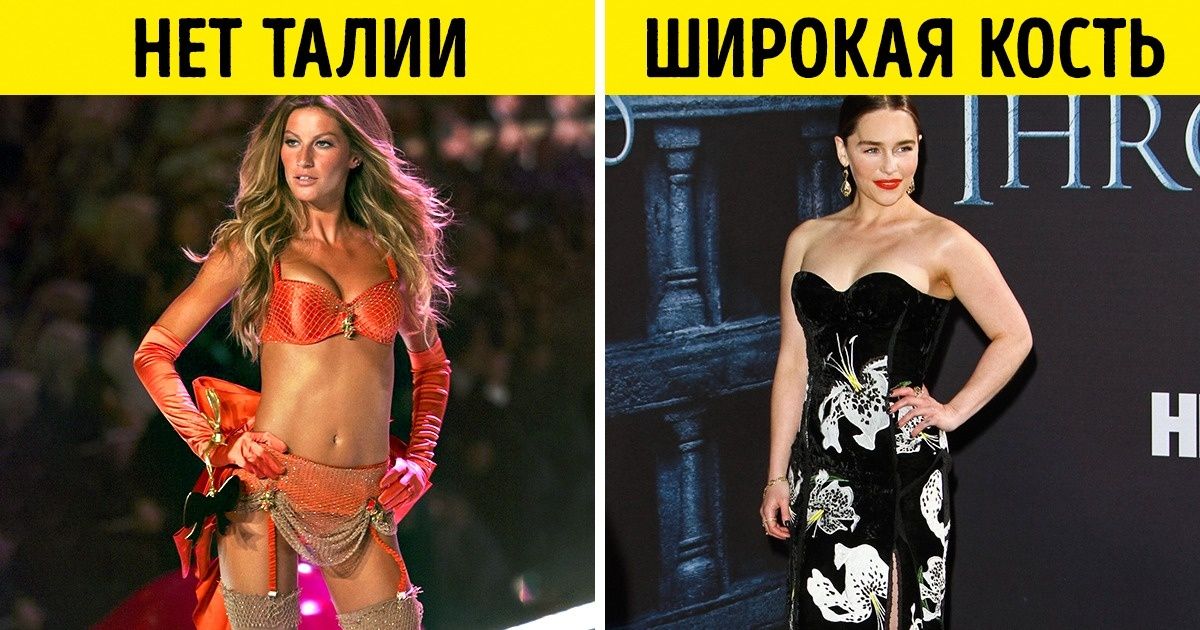 недостатки фигуры