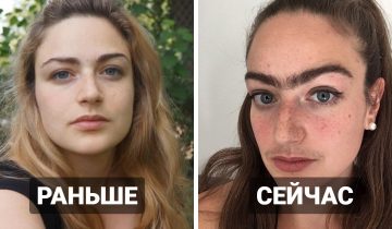 удалять волосы на лице