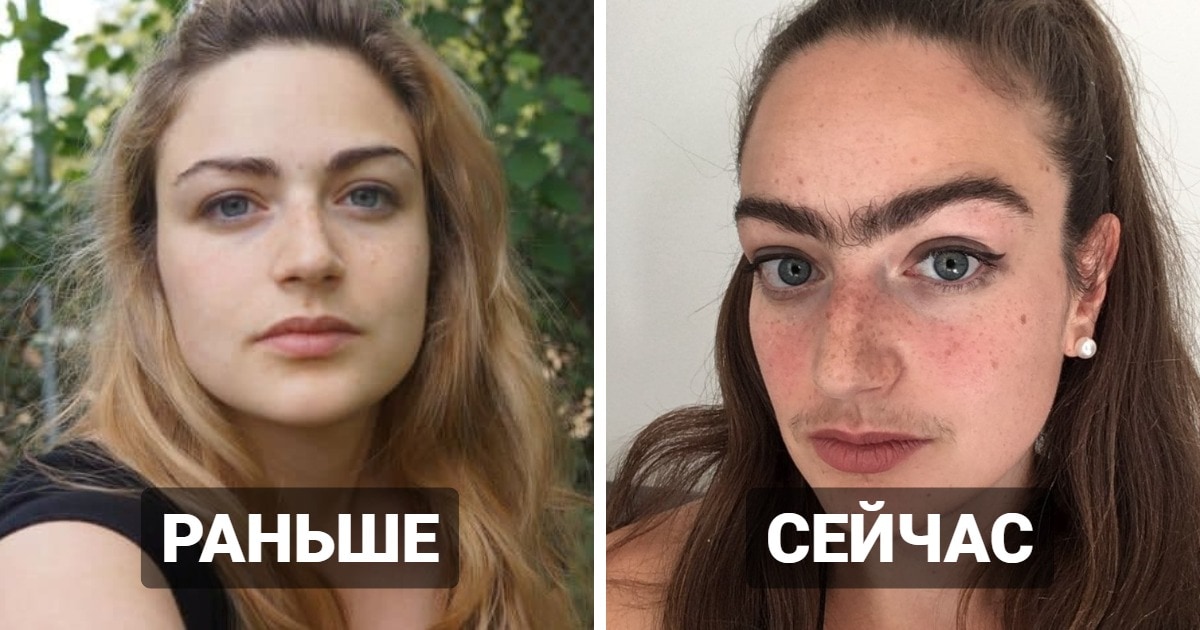 удалять волосы на лице