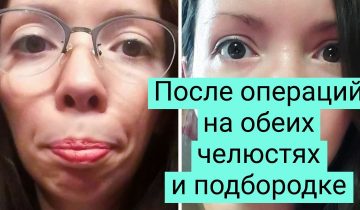решились поменять свою внешность