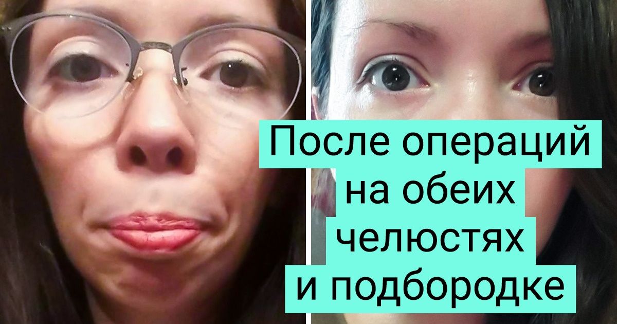решились поменять свою внешность
